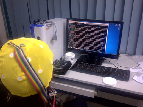 QEEG recording with discovery 24 channel amplifier