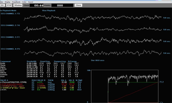 Readout of 4 channel Z-score Training